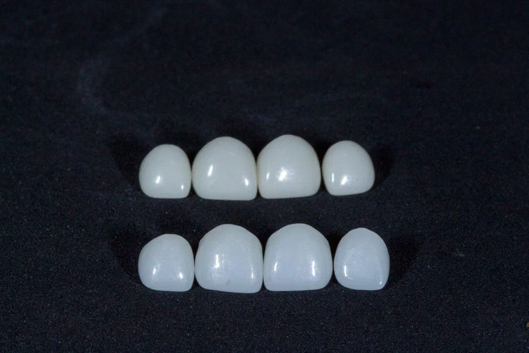 Детские коронки из диоксида циркония (ZrO2), 1 ед.