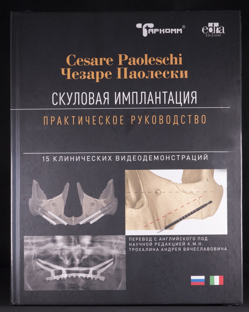 Скуловая имплантация. Практическое руководство - Чезаре Паолески М.:ТАРКОММ - 2026