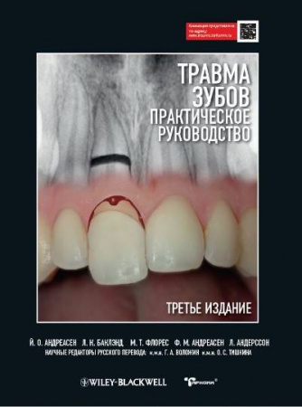 Книга "Травма зубов. Практическое руководство"