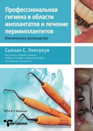 Книга "Профессиональная гигиена в области имплантатов и лечение периимплантитов"