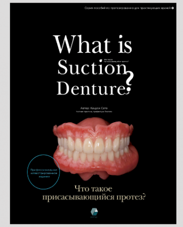 Книга "Что такое присасывающийся протез?"