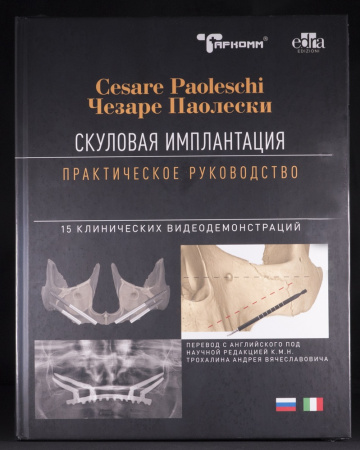 Скуловая имплантация. Практическое руководство - Чезаре Паолески М.:ТАРКОММ - 2026