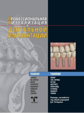 Книга "Профессиональная визуализация в дентальной имплантации"